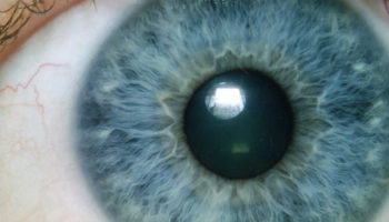 Computerized Iridology Explained